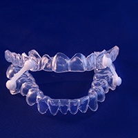 Close up of custom-made oral appliance with blue background