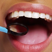 Closeup of smile during dental exam