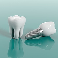 model of a real tooth next to a dental implant