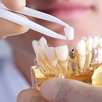 dentist placing a crown onto a model of a dental implant in the jaw