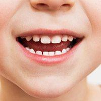 Closeup of child's healthy smile