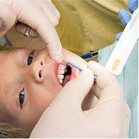 Child receiving fluoride treatment