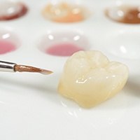 Dental crown on table top