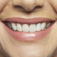 Closeup of healthy teeth and gums