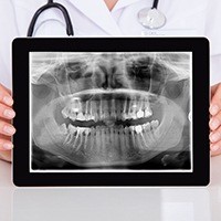 Dental x-rays on tablet computer