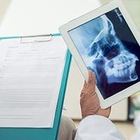 X-ray of skull on tablet computer