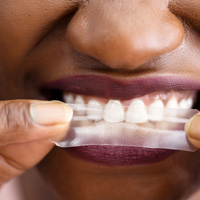 Nose-to-chin closeup of woman applying whitening strip to upper arch