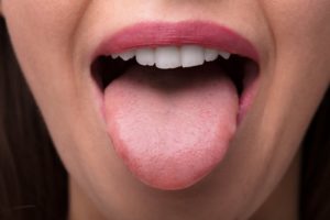 Should you scrape your tongue?