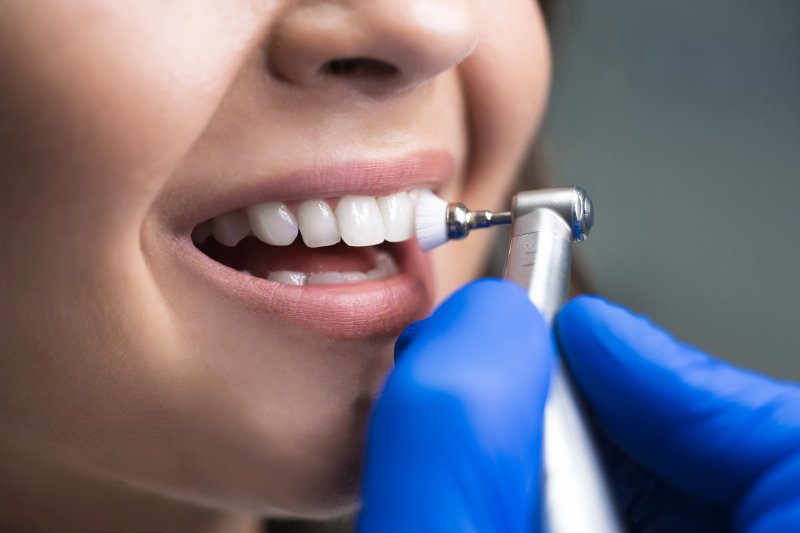 Woman having her teeth gently cleaned with a brush