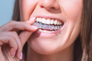 woman with clear aligners 